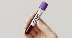 What is CA125 Blood Test, Know its Procedure, Price, Result Interpretation